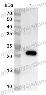 Anti-Human TIMM8A Polyclonal Antibody