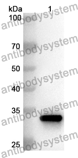 Anti-Human SH3BP5 Polyclonal Antibody