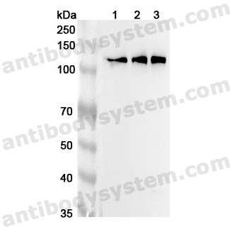 Anti-Human KIF5C Polyclonal Antibody