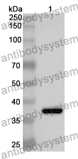 Anti-Human NUAK1 Polyclonal Antibody