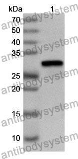 Anti-Human MGRN1 Polyclonal Antibody