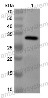 Anti-Human TRAK2 Polyclonal Antibody