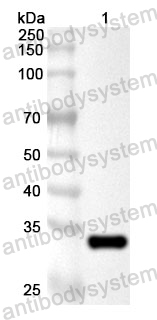 Anti-Human KIF1B Polyclonal Antibody