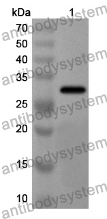 Anti-Human PHLPP1 Polyclonal Antibody