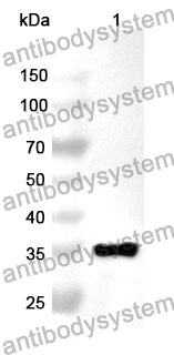 Anti-PPL Polyclonal Antibody