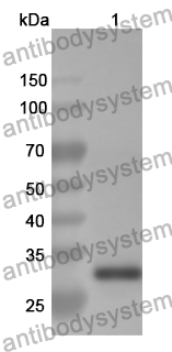 Anti-NRP2 Polyclonal Antibody