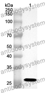 Anti-ACSL4 Polyclonal Antibody