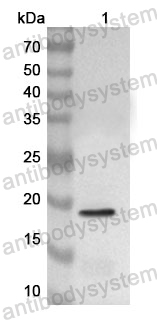 Anti-Human SNX3 Polyclonal Antibody