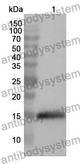 Anti-CUBN Polyclonal Antibody