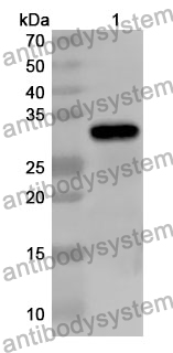 Anti-OGA Polyclonal Antibody