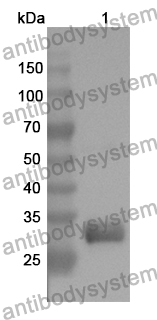 Anti-ADCY9 Polyclonal Antibody