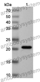 Anti-Human CIDEA Polyclonal Antibody