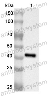 Anti-Human GMDS Polyclonal Antibody