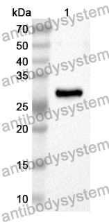 Anti-Human PLOD3 Polyclonal Antibody