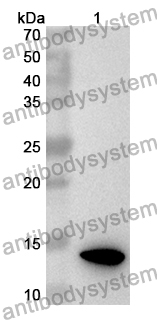 Anti-Human TLR5 Polyclonal Antibody