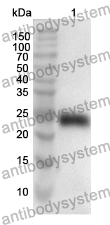 Anti-DIAPH1 Polyclonal Antibody