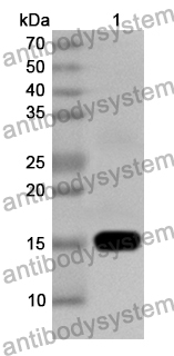 Anti-Human LMX1B Polyclonal Antibody