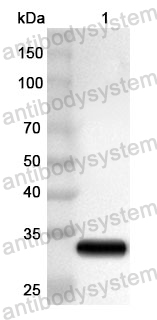 Anti-Human RAD1 Polyclonal Antibody