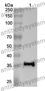 Anti-JAK2 Polyclonal Antibody