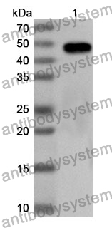 Anti-Human SRPX2 Polyclonal Antibody