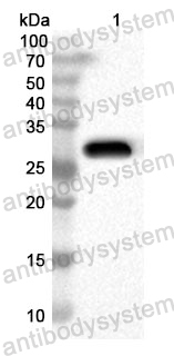 Anti-Human CTNND1 Polyclonal Antibody