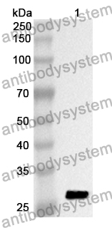 Anti-PLA2G6 Polyclonal Antibody