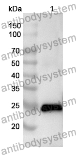 Anti-HPGDS Polyclonal Antibody