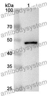 Anti-Human PFKFB2 Polyclonal Antibody