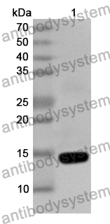 Anti-Human CCDC22 Polyclonal Antibody