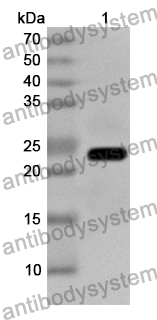 Anti-Human OPHN1 Polyclonal Antibody