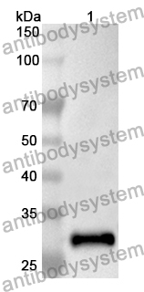 Anti-Human SMPD2 Polyclonal Antibody