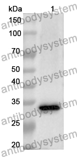 Anti-CTSV Polyclonal Antibody