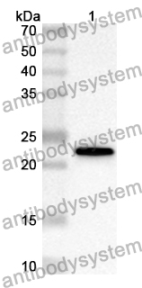 Anti-Human CTNS Polyclonal Antibody