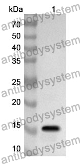 Anti-Human NBN Polyclonal Antibody