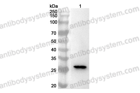 Anti-Human NOL3 Polyclonal Antibody