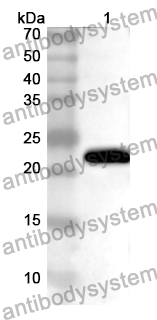 Anti-CD16b/FCGR3B Polyclonal Antibody