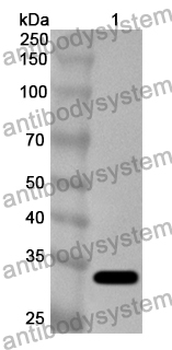 Anti-ABCB7 Polyclonal Antibody