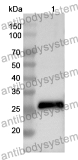 Anti-NOS1AP Polyclonal Antibody