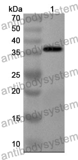 Anti-Human WDR1 Polyclonal Antibody