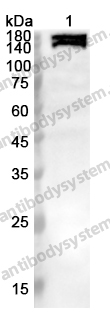 Anti-ROCK2 Polyclonal Antibody