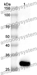 Anti-HIP1R Polyclonal Antibody