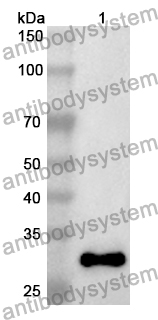 Anti-Human NPHP4 Polyclonal Antibody