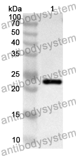 Anti-KDM4A Polyclonal Antibody