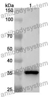 Anti-Human SS18L1 Polyclonal Antibody