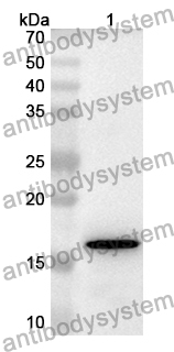 Anti-Human DNAJB6 Polyclonal Antibody