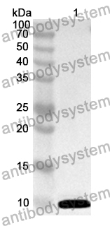 Anti-LRP5 Polyclonal Antibody