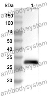 Anti-CDH16 Polyclonal Antibody