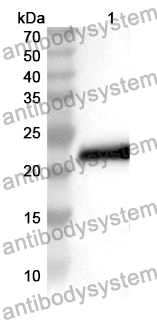 Anti-DUSP11 Polyclonal Antibody