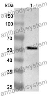 Anti-CILP Polyclonal Antibody