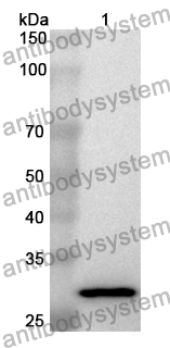 Anti-ALOX12B Polyclonal Antibody